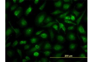 Immunofluorescence of monoclonal antibody to RLBP1 on HeLa cell. (RLBP1 antibody  (AA 1-317))