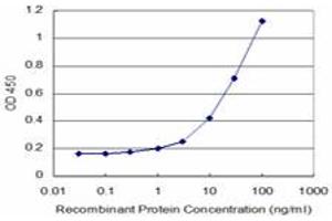 Detection limit for recombinant GST tagged LHX5 is approximately 1ng/ml as a capture antibody. (LHX5 antibody  (AA 114-182))