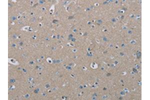 The image on the left is immunohistochemistry of paraffin-embedded Human brain tissue using ABIN7191864(PHKA2 Antibody) at dilution 1/30, on the right is treated with synthetic peptide. (PHKA2 antibody)