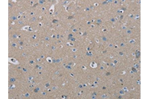 PHKA2 antibody