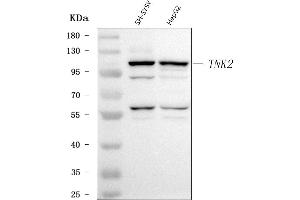 Western blot analysis of ACK1/TNK2 using anti-ACK1/TNK2 antibody (ABIN7601859).
