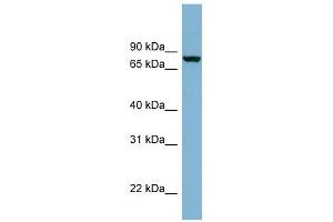 Neurochondrin antibody used at 1 ug/ml to detect target protein.