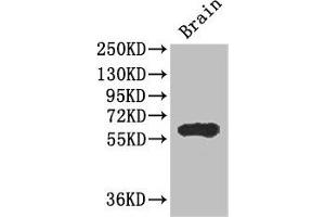 Western Blot Positive WB detected in: Mouse brain tissue All lanes: ICE1 antibody at 2. (ICE1 (AA 1213-1505) antibody)