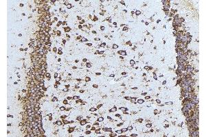 ABIN6275540 at 1/100 staining Mouse brain tissue by IHC-P. (TAO Kinase 1 (TAOK1) (Internal Region) antibody)