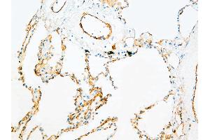 Immunohistochemistry (IHC) image for anti-Platelet/endothelial Cell Adhesion Molecule (PECAM1) antibody (ABIN108424) (CD31 antibody)