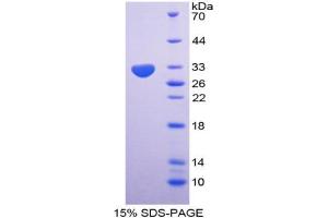 Image no. 1 for Nucleoporin 85kDa (NUP85) (AA 130-368) protein (His tag) (ABIN4988606) (NUP85 Protein (AA 130-368) (His tag))