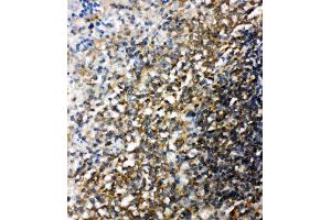 Anti-Bid antibody, IHC(P) IHC(P): Rat Spleen Tissue (BID antibody  (C-Term))