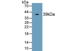 Detection of Recombinant ST2, Human using Monoclonal Antibody to Syntenin 2 (ST2) (SDCBP2 antibody  (AA 1-292))