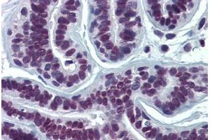 Human Breast: Formalin-Fixed, Paraffin-Embedded (FFPE)