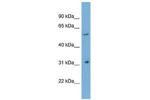 REM1 antibody used at 1 ug/ml to detect target protein. (REM1 antibody)
