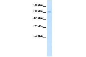WB Suggested Anti-TRIM17 Antibody Titration:  0. (TRIM17 / RNF16 antibody  (Middle Region))