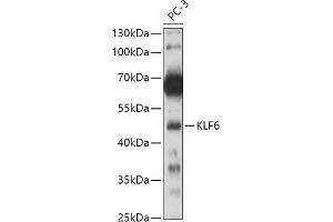 Western blot analysis of extracts of PC-3 cells, using KLF6 antibody (ABIN6131578, ABIN6142923, ABIN6142924 and ABIN6214111) at 1:500 dilution.