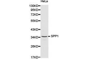Western Blotting (WB) image for anti-Secreted phosphoprotein 1 (SPP1) antibody (ABIN1874926) (Osteopontin antibody)