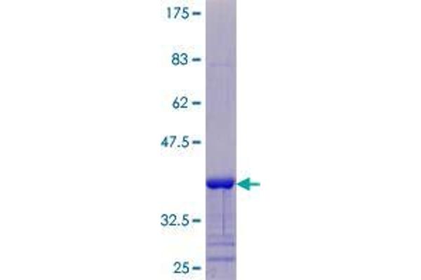 SPRR4 Protein (AA 1-79) (GST tag)