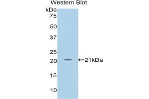 Detection of Recombinant L1CAM, Human using Polyclonal Antibody to L1-Cell Adhesion Molecule (L1CAM) (L1CAM antibody  (AA 526-690))