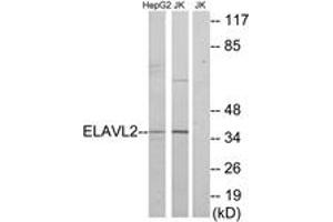 Western blot analysis of extracts from HepG2/Jurkat cells, using ELAVL2 Antibody.