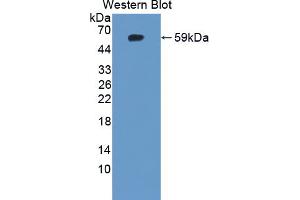 Western blot analysis of the recombinant protein. (IDS antibody  (AA 107-363))