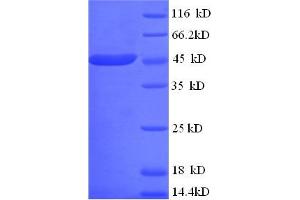 SDS-PAGE (SDS) image for Hepatitis A Virus Cellular Receptor 1 (HAVCR1) (AA 17-397) protein (His tag) (ABIN5708989) (HAVCR1 Protein (AA 17-397) (His tag))