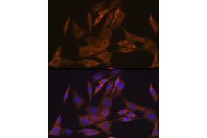 Immunofluorescence analysis of NIH-3T3 cells using KIF Rabbit mAb (ABIN7268120) at dilution of 1:100 (40x lens). (KIFAP3 antibody)