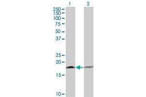 Western Blot analysis of PTH expression in transfected 293T cell line by PTH monoclonal antibody (M13), clone 3D7. (PTH antibody  (AA 32-115))