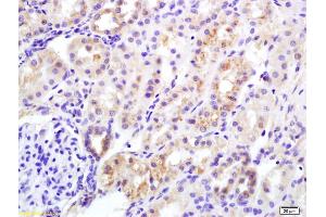 Formalin-fixed and paraffin embedded rat kidney labeled with Rabbit Anti Insulin Receptor Alpha Polyclonal Antibody, Unconjugated (ABIN726965) at 1:200 followed by conjugation to the secondary antibody and DAB staining