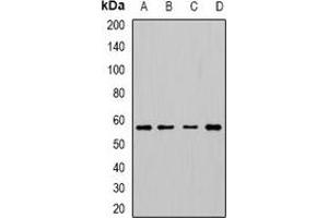 Western blot analysis of Cytochrome P450 3A5 expression in HepG2 (A), SW480 (B), mouse lung (C), mouse thumus (D) whole cell lysates.