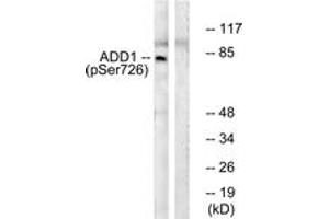 Western blot analysis of extracts from HeLa cells treated with Forskolin 40nM 30', using ADD1 (Phospho-Ser726) Antibody. (alpha Adducin antibody  (pSer726))