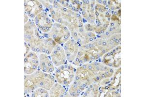 Immunohistochemistry of paraffin-embedded mouse kidney using USH1C antibody (ABIN5972448) at dilution of 1/100 (40x lens). (USH1C antibody)
