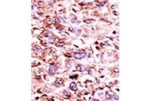 Image no. 2 for anti-Checkpoint Kinase 1 (CHEK1) (pSer280) antibody (ABIN358108) (CHEK1 antibody  (pSer280))