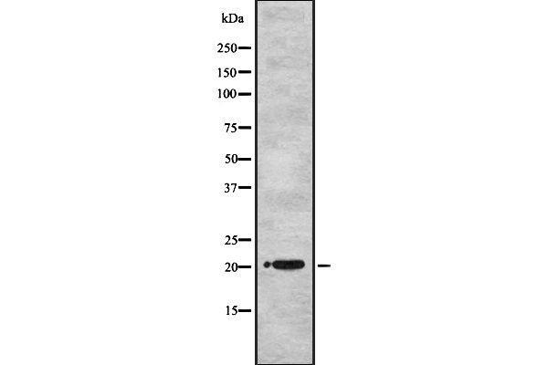 UBE2M antibody  (Internal Region)