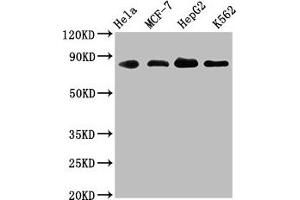 Western Blot Positive WB detected in: Hela whole cell lysate, MCF-7 whole cell lysate, HepG2 whole cell lysate, K562 whole cell lysate All lanes: ARNT antibody at 1. (Recombinant ARNT antibody)