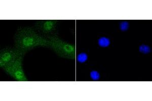 3T3 cells were stained with Akt1(Ser473) (12A1) Monoclonal Antibody  at [1:200] incubated overnight at 4C, followed by secondary antibody incubation, DAPI staining of the nuclei and detection. (AKT1 antibody  (pSer473))