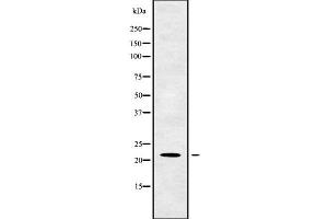 Western blot analysis of TM2D1 using K562 whole cell lysates (TM2D1 antibody  (Internal Region))