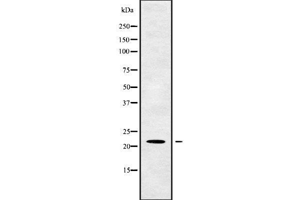TM2D1 antibody  (Internal Region)