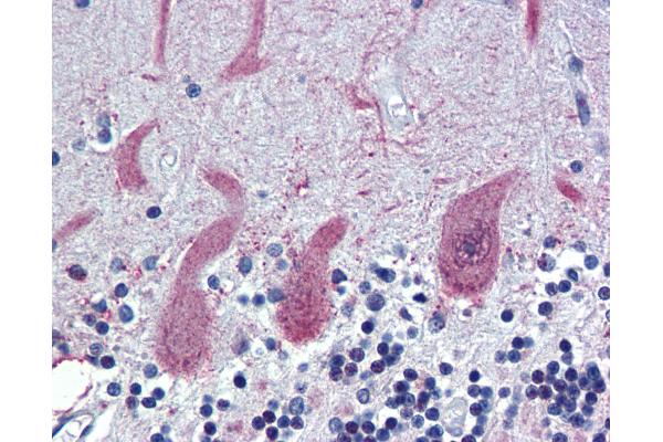 ST18 antibody  (AA 899-948)