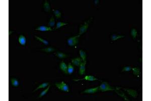Immunofluorescent analysis of Hela cells using ABIN7163218 at dilution of 1:100 and Alexa Fluor 488-congugated AffiniPure Goat Anti-Rabbit IgG(H+L) (PIGP antibody  (AA 1-282))