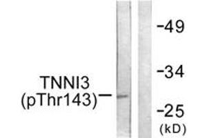 Western blot analysis of extracts from mouse heart, using TNNI3 (Phospho-Thr142) Antibody. (TNNI3 antibody  (pThr142))