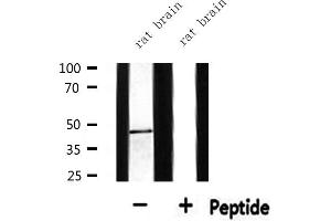 Western blot analysis of extracts from rat brain, using BCKD Antibody. (BCKDK antibody  (N-Term))