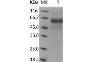 DDR2 Protein (His tag)