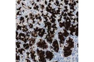 Immunohistochemical staining of human stomach with ULBP1 polyclonal antibody  shows strong cytoplasmic positivity in glandular cells at 1:50-1:200 dilution.