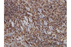 Image no. 2 for anti-Hematopoietic Cell-Specific Lyn Substrate 1 (HCLS1) (AA 266-356) antibody (ABIN598723) (HCLS1 antibody  (AA 266-356))