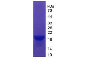 SDS-PAGE of Protein Standard from the Kit (Highly purified E. (Vitronectin ELISA Kit)