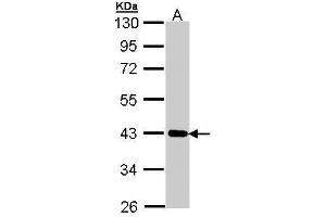 WB Image Sample (30 ug of whole cell lysate) A: A431 , 10% SDS PAGE antibody diluted at 1:1000