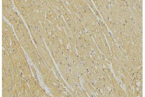 Immunohistochemistry (IHC) image for anti-BCL2-Interacting Killer (Apoptosis-Inducing) (BIK) antibody (ABIN6260261)