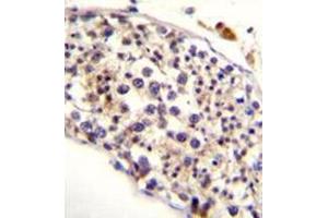 Immunohistochemistry analysis in formalin fixed and paraffin embedded human testis tissue reacted with HAUS3 Antibody (Center) followed by peroxidase conjugation of the secondary antibody and DAB staining. (HAUS3 antibody  (Middle Region))