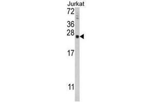Western blot analysis of TPT1 Antibody (Center) in Jurkat cell line lysates (35ug/lane). (TPT1 antibody  (Middle Region))