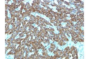 Recombinant Keratin Basic antibody