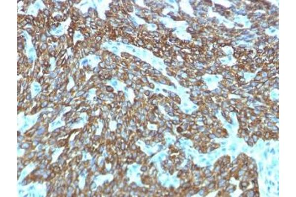 Recombinant Keratin Basic antibody