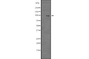 Western blot analysis of E2F7 expression in SP2/0 cell lysate ,The lane on the left is treated with the antigen-specific peptide. (E2F7 antibody)