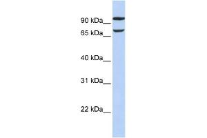 WB Suggested Anti-FAM38B Antibody Titration:  0. (PIEZO2 antibody  (Middle Region))